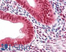 CBX5 / HP1 Alpha Antibody - Anti-CBX5 / HP1 antibody IHC of human uterus. Immunohistochemistry of formalin-fixed, paraffin-embedded tissue after heat-induced antigen retrieval. Antibody concentration 5 ug/ml.