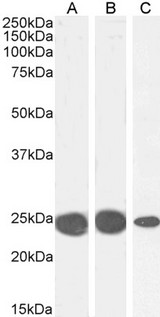 CBX5 / HP1 Alpha Antibody - CBX5 / HP1 Alpha antibody (0.1µg/ml) staining of K562 (A), MCF7 (B) and NIH3T3 (C) cell lysate (35µg protein in RIPA buffer). Detected by chemiluminescence.