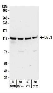 CCAR2 / KIAA1967 Antibody - Detection of Mouse DBC1 by Western Blot. Samples: Whole cell lysate (50 ug) from TCMK-1, Renca, 4T1, and CT26.WT cells. Antibodies: Affinity purified rabbit anti-DBC1 antibody used for WB at 1 ug/ml. Detection: Chemiluminescence with an exposure time of 30 seconds.