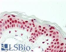 CCAR2 / KIAA1967 Antibody - Human Skin: Formalin-Fixed, Paraffin-Embedded (FFPE)