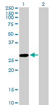 CCBL1 Antibody - Western Blot analysis of CCBL1 expression in transfected 293T cell line by CCBL1 monoclonal antibody (M02), clone 1B12.Lane 1: CCBL1 transfected lysate(27.4 KDa).Lane 2: Non-transfected lysate.