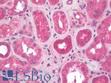 CCBL1 Antibody - Human Kidney: Formalin-Fixed, Paraffin-Embedded (FFPE)