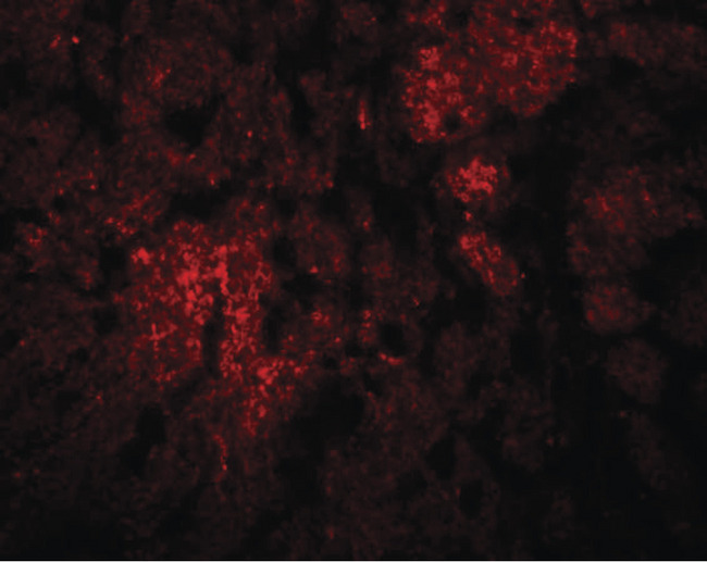 CCDC106 Antibody - Immunofluorescence of CCDC106 in rat brain tissue with CCDC106 antibody at 20 ug/ml.
