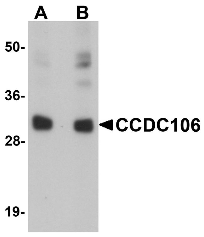 CCDC106 Antibody - Western blot analysis of CCDC106 in human brain tissue lysate with CCDC106 antibody at (A) 0.5 and (B) 1 ug/ml.