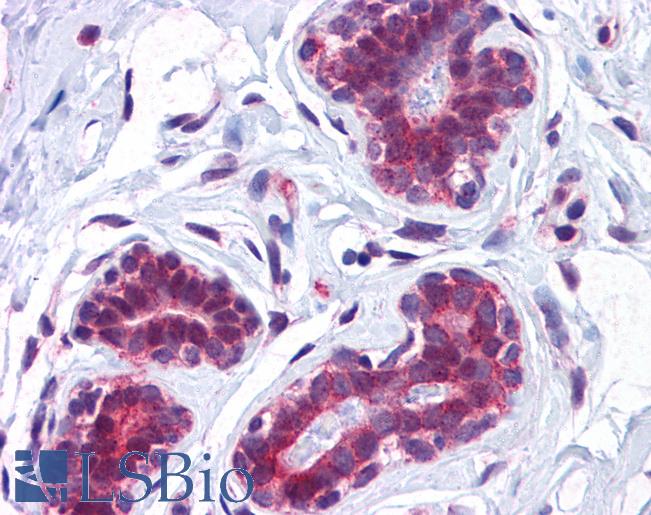 CCDC106 Antibody - Anti-CCDC106 antibody IHC of human breast. Immunohistochemistry of formalin-fixed, paraffin-embedded tissue after heat-induced antigen retrieval. Antibody concentration 5 ug/ml.