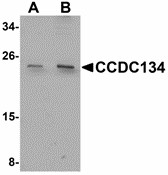 CCDC134 Antibody - Western blot of CCDC134 in rat brain tissue lysate with CCDC134 antibody at (A) 1 and (B) 2 ug/ml.