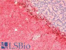 CCDC141 Antibody - Anti-CCDC141 antibody IHC staining of human brain, cerebellum. Immunohistochemistry of formalin-fixed, paraffin-embedded tissue after heat-induced antigen retrieval. Antibody concentration 5 ug/ml.