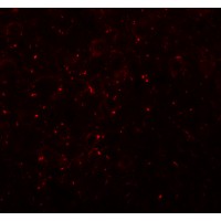 CCDC141 Antibody - Immunofluorescence of CCDC141 in mouse brain tissue with CCDC141 antibody at 20 µg/mL.