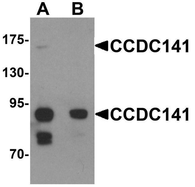 CCDC141 Antibody - Western blot analysis of CCDC141 in SK-N-SH cell tissue lysate with CCDC141 antibody at 1 ug/ml in (A) the absence and (B) the presence of blocking peptide