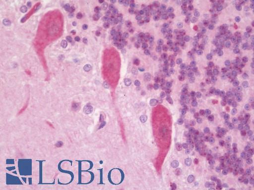 CCDC170 / C6orf97 Antibody - Anti-CCDC170 / C6orf97 antibody IHC staining of human brain, cerebellum. Immunohistochemistry of formalin-fixed, paraffin-embedded tissue after heat-induced antigen retrieval. Antibody concentration 5 ug/ml.