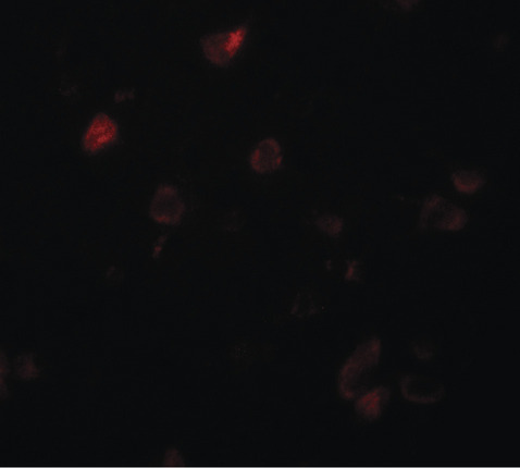 CCDC22 Antibody - Immunofluorescence of CCDC22 in human brain tissue with CCDC22 antibody at 20 ug/ml.
