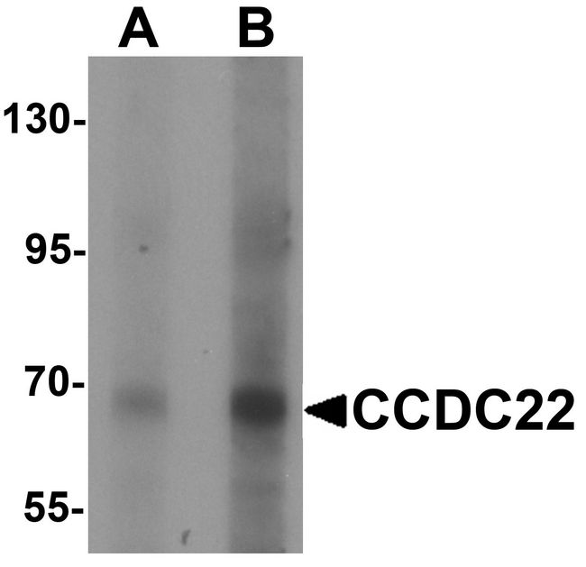 CCDC22 Antibody - Western blot analysis of CCDC22 in 293 cell lysate with CCDC22 antibody at (A) 1 and (B) 2 ug/ml.