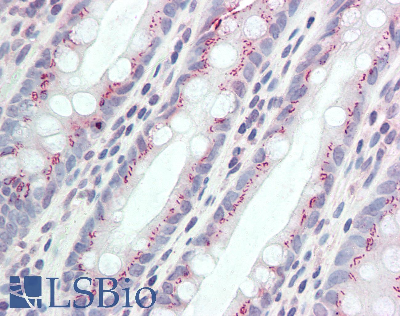 CCDC3 Antibody - Anti-CCDC3 antibody IHC staining of human colon. Immunohistochemistry of formalin-fixed, paraffin-embedded tissue after heat-induced antigen retrieval. Antibody concentration 5 ug/ml.