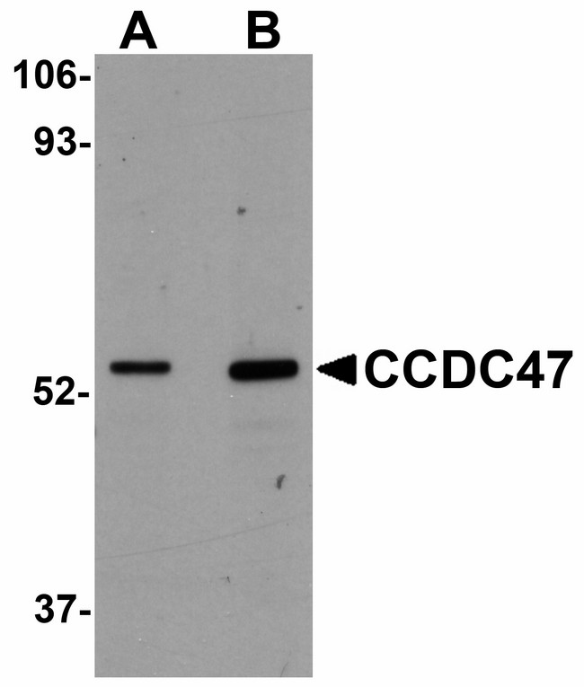 CCDC47 Antibody - Western blot of CCDC47 in mouse heart tissue lysate with CCDC47 antibody at (A) 1 and (B) 2 ug/ml.