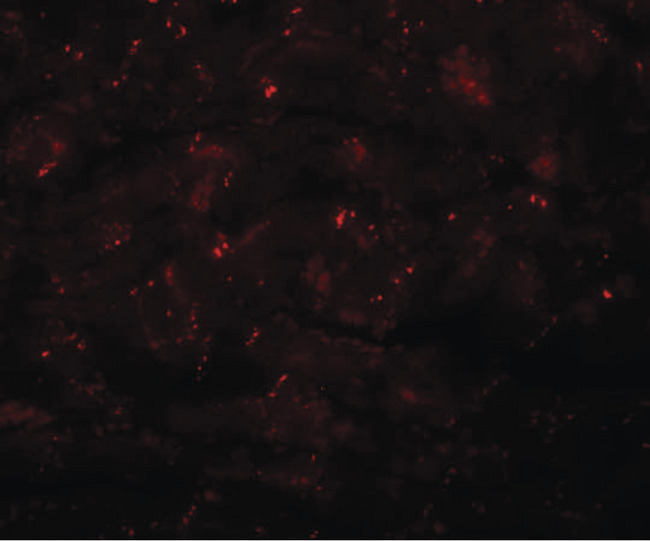 CCDC47 Antibody - Immunofluorescence of CDCC47 in mouse heart tissue with CDCC47 antibody at 20 ug/ml.