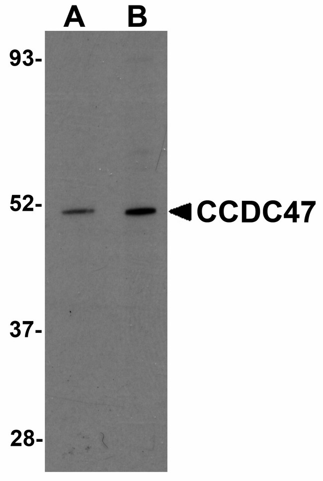 CCDC47 Antibody - Western blot of CCDC47 in mouse heart tissue lysate with CCDC47 antibody at (A) 1 and (B) 2 ug/ml.