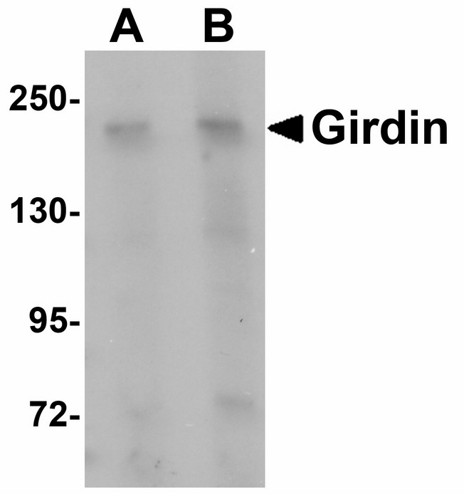 CCDC88A / GIV / Girdin Antibody - Western blot of Girdin in rat brain tissue lysate with Girdin antibody at (A) 1 and (B) 2 ug/ml.