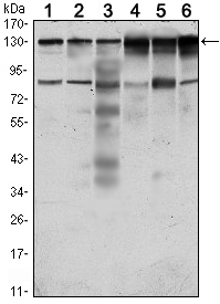 CCK4 / PTK7 Antibody - Western blot using PTK7 mouse monoclonal antibody against HeLa (1), A431 (2), HCT116 (3), Caco2 (4), HepG2 (5) and MCF-7 (6) cell lysate.