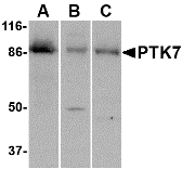 CCK4 / PTK7 Antibody - Western blot of PTK7 in (A) human colon, (B) mouse kidney and (C) rat liver tissue lysate with PTK7 antibody at 1 ug/ml.
