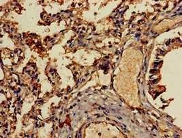 CCL13 / MCP4 Antibody - Immunohistochemistry of paraffin-embedded human lung tissue using CCL13 Antibody at dilution of 1:100
