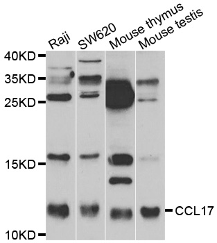CCL17 / TARC Antibody - Western blot analysis of extracts of NCL-H460.