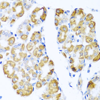 CCL17 / TARC Antibody - Immunohistochemistry of paraffin-embedded human stomach tissue.