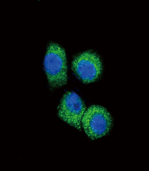 CCL2 / MCP1 Antibody - Confocal immunofluorescence of CCL2 Antibody with HeLa cell followed by Alexa Fluor 488-conjugated goat anti-rabbit lgG (green). DAPI was used to stain the cell nuclear (blue).