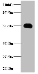CCL2 / MCP1 Antibody - Western blot All lanes: C-C motif chemokine 2 antibody at 2µg/ml + EC109 whole cell lysate at 20 µg Secondary Goat polyclonal to rabbit IgG at 1/15000 dilution Predicted band size: 11 kDa Observed band size: 50 kDa