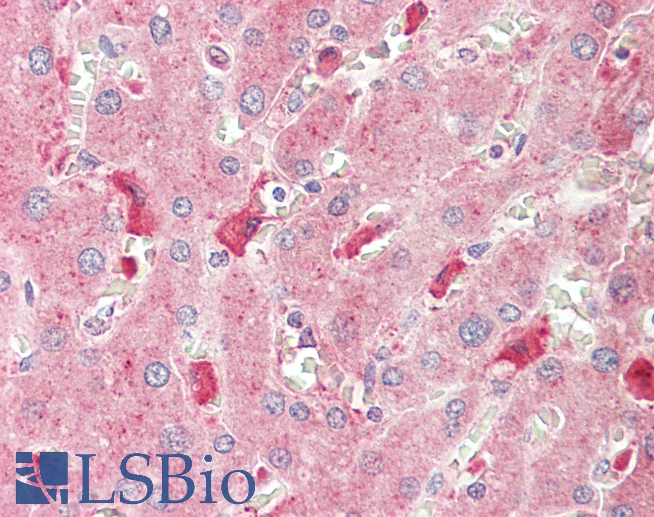 CCL2 / MCP1 Antibody - Anti-CCL2 / MCP1 antibody IHC staining of human liver. Immunohistochemistry of formalin-fixed, paraffin-embedded tissue after heat-induced antigen retrieval. Antibody concentration 20 ug/ml. This image was taken for the unconjugated form of this product. Other forms have not been tested.
