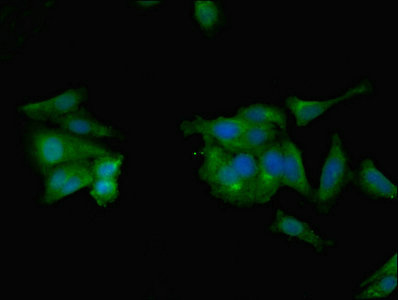 CCL2 / MCP1 Antibody - Immunofluorescent analysis of Hela cells using CCL2 Antibody at dilution of 1:100 and Alexa Fluor 488-congugated AffiniPure Goat Anti-Rabbit IgG(H+L)