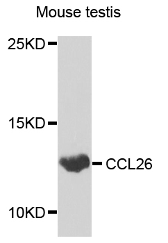 CCL26 / Eotaxin 3 Antibody - Western blot analysis of extracts of various cells, using CCL26 antibody.