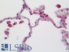 CCL3 / MIP-1-Alpha Antibody - Anti-CCL3 / MIP-1-Alpha antibody IHC staining of human lung. Immunohistochemistry of formalin-fixed, paraffin-embedded tissue after heat-induced antigen retrieval. Antibody dilution 1:50.