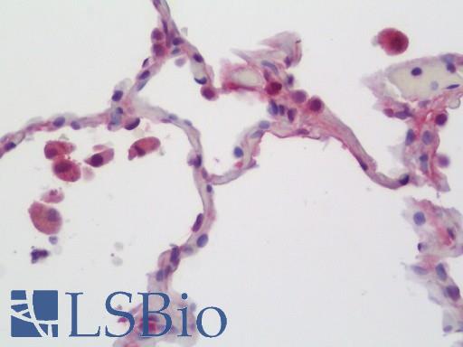 CCL3 / MIP-1-Alpha Antibody - Anti-CCL3 / MIP-1-Alpha antibody IHC staining of human lung. Immunohistochemistry of formalin-fixed, paraffin-embedded tissue after heat-induced antigen retrieval. Antibody dilution 1:50.