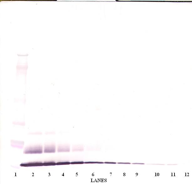 CCL8 / MCP2 Antibody - Anti-Human MCP-2 (CCL8) Western Blot Unreduced