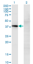 CCN3 / NOV Antibody - Western blot of NOV expression in transfected 293T cell line by NOV monoclonal antibody, clone 2G8.