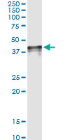 CCN3 / NOV Antibody - Immunoprecipitation of NOV transfected lysate using anti-NOV monoclonal antibody and Protein A magnetic bead, immunoblotted with NOV rabbit polyclonal antibody.