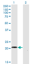 CCN5 Antibody - Western blot of WISP2 expression in transfected 293T cell line by WISP2 monoclonal antibody, clone 1E11.