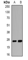 CCN5 Antibody - Western blot analysis of WISP2 expression in HeLa (A); mouse lung (B) whole cell lysates.