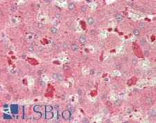 CCN5 Antibody - Human Liver: Formalin-Fixed, Paraffin-Embedded (FFPE)