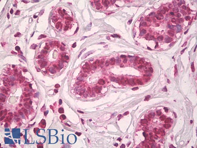 CCNB1 / Cyclin B1 Antibody - Anti-Cyclin B1 antibody IHC of human breast. Immunohistochemistry of formalin-fixed, paraffin-embedded tissue after heat-induced antigen retrieval. Antibody dilution 10 ug/ml.