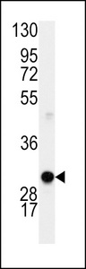 CCND1 / Cyclin D1 Antibody - Western blot of anti-Cyclin D1 Antibody (S90) in mouse lung lysates (35 ug/lane). Cyclin D1(arrow) was detected using the purified antibody.