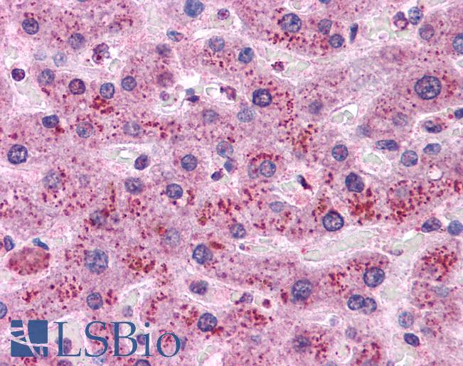 CCND1 / Cyclin D1 Antibody - Anti-CCND1 / Cyclin D1 antibody IHC of human liver. Immunohistochemistry of formalin-fixed, paraffin-embedded tissue after heat-induced antigen retrieval. Antibody concentration 10 ug/ml.