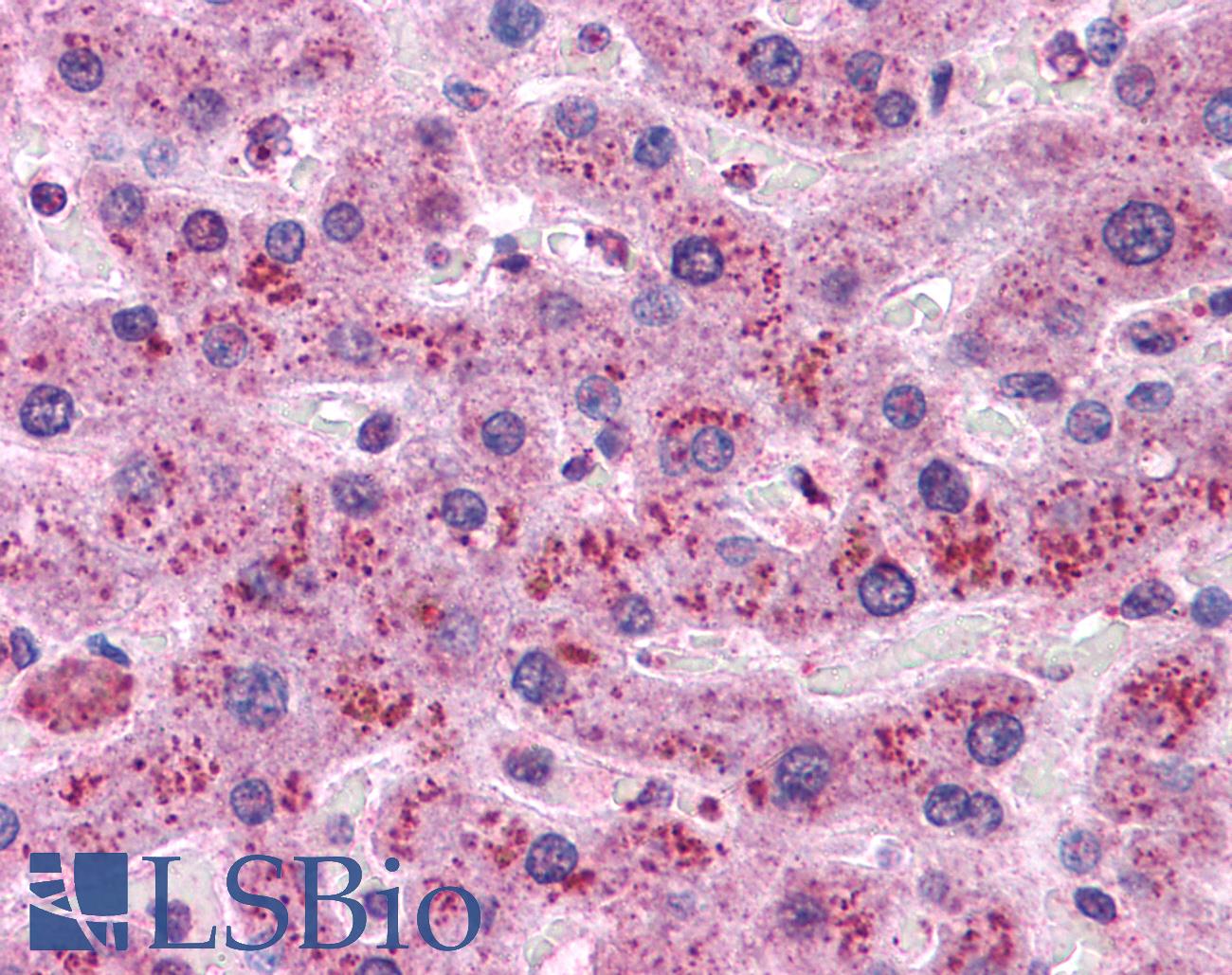 CCND1 / Cyclin D1 Antibody - Anti-CCND1 / Cyclin D1 antibody IHC of human liver. Immunohistochemistry of formalin-fixed, paraffin-embedded tissue after heat-induced antigen retrieval. Antibody concentration 10 ug/ml.