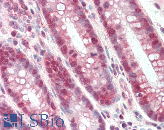 CCND1 / Cyclin D1 Antibody - Anti-CCND1 / Cyclin D1 antibody IHC staining of human colon. Immunohistochemistry of formalin-fixed, paraffin-embedded tissue after heat-induced antigen retrieval.