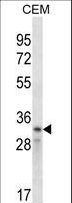 CCND2 / Cyclin D2 Antibody - CCND2 Antibody western blot of CEM cell line lysates (35 ug/lane). The CCND2 antibody detected the CCND2 protein (arrow).