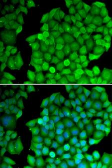 CCND2 / Cyclin D2 Antibody - Immunofluorescence analysis of U2OS cells.