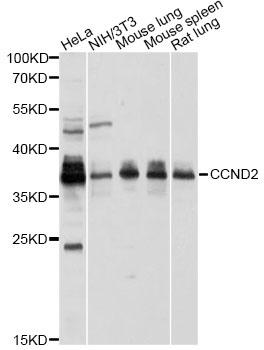 CCND2 / Cyclin D2 Antibody - Western blot analysis of extracts of various cell lines, using CCND2 antibody at 1:1000 dilution. The secondary antibody used was an HRP Goat Anti-Rabbit IgG (H+L) at 1:10000 dilution. Lysates were loaded 25ug per lane and 3% nonfat dry milk in TBST was used for blocking. An ECL Kit was used for detection and the exposure time was 10s.