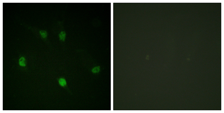 CCNE1 / Cyclin E1 Antibody - Immunofluorescence analysis of HeLa cells, using Cyclin E1 Antibody. The picture on the right is blocked with the synthesized peptide.