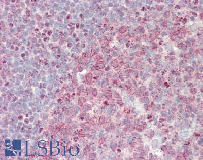 CCNH / Cyclin H Antibody - Human Tonsil: Formalin-Fixed, Paraffin-Embedded (FFPE)