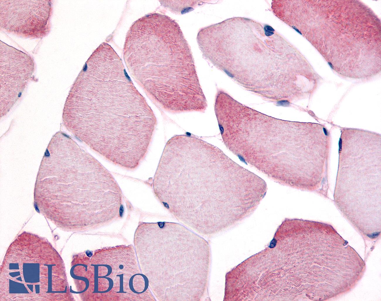 CCNL1 / Cyclin L1 Antibody - Anti-CCNL1 / Cyclin L1 antibody IHC of human skeletal muscle. Immunohistochemistry of formalin-fixed, paraffin-embedded tissue after heat-induced antigen retrieval. Antibody concentration 10 ug/ml.